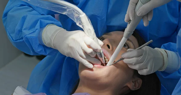 Femme Subissent Traitement Détartrage Dentaire — Photo