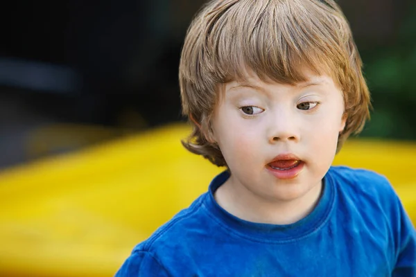 Chlapec Downovým Syndromem — Stock fotografie