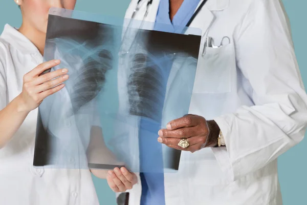 保健专业人员中段分析X光报告 — 图库照片