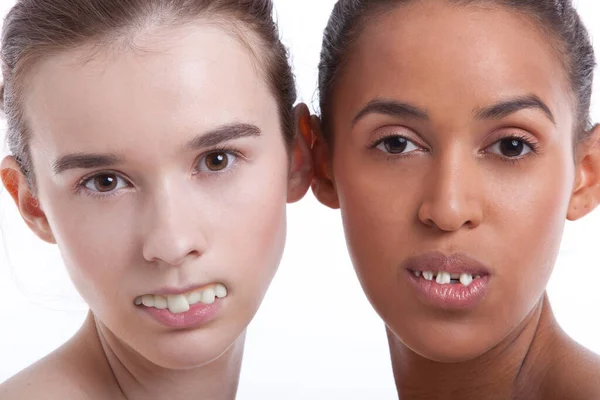 Porträtt Två Unga Kvinnor Med Falska Tänder Mot Vit Bakgrund — Stockfoto
