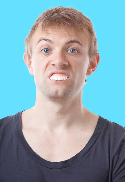 Homme Caucasien Avec Mauvaises Dents — Photo