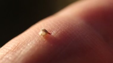 Arıyı korumak için saldırganın vücuduna giren zehri ince bir iğneyle kullanır. İnsan vücudundaki terk edilmiş arı iğnesi hareket eder ve zehirli bir şişe yayar..