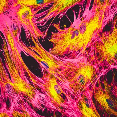 Real fluorescence microscopic view of human skin cells in culture. Nucleus are in blue, actin filaments are in pink, tubulin was labeled with yellow clipart