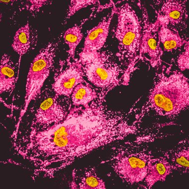 Mezenkimal Buhar hücrelerde mitokondri confocal görüntüsü. Mitochondrias pembe boyama ile etiketlenir, hücre çekirdeği içinde sarı renk