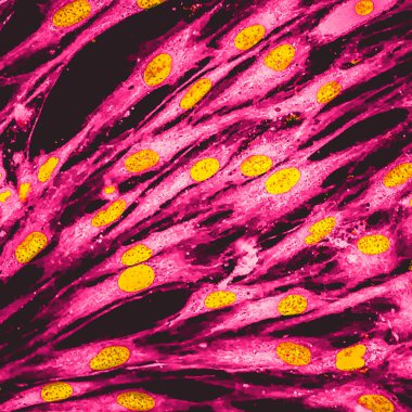 Real fluorescence microscopic view of human skin cells in culture. Nucleus are in yellow, cell membranes were labeled with pink clipart