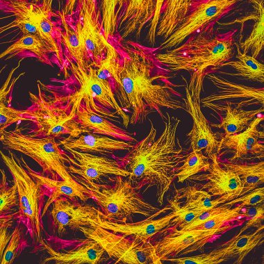 Real fluorescence microscopic view of human skin cells in culture. Nucleus are in blue, actin filaments are in pink, tubulin was labeled with green clipart