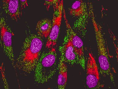 Mezenkimal Buhar hücrelerde mitokondri confocal görüntüsü. Mitochondrias yeşil boyama ile etiketlenir, hücre çekirdeği mor