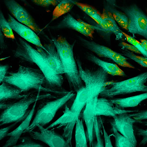 Gerçek Floresans Mikroskobik Görünümü Insan Deri Hücrelerinin Pseudocolored — Stok fotoğraf