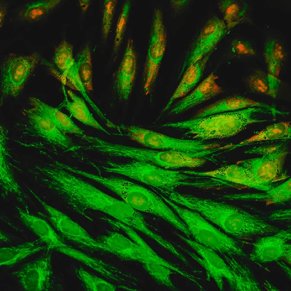 Vista Microscopica Fluorescenza Reale Delle Cellule Cutanee Umane Pseudocolorate — Foto Stock