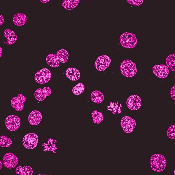 人急性白血病细胞系 K562 的共焦显微术 活细胞被染色的分子 Dna — 图库照片