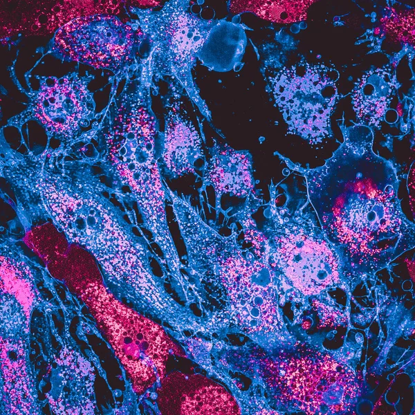 Mezenkimal Buhar hücrelerde mitokondri confocal görüntüsü. Mitochondrias pembe boyama ile etiketlenir, mavi hücreler mebranes vardır