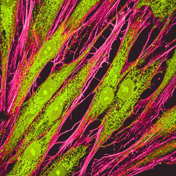 人类皮肤细胞在培养中的真实荧光显微观察 肌动蛋白花丝呈红色 蛋白被标记为绿色 — 图库照片