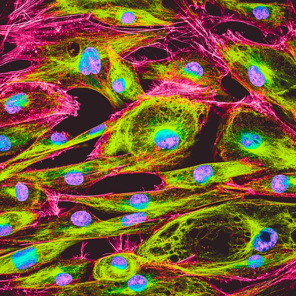 人类皮肤细胞在培养中的真实荧光显微观察 细胞核呈蓝色 肌动蛋白花丝呈粉红色 蛋白被标记为绿色 — 图库照片