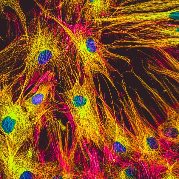 Igazi Fluoreszcens Mikroszkópos Kilátás Emberi Bőr Sejtek Ban Kultúra Nucleus — Stock Fotó
