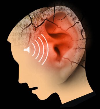 Kulak ve baş kırık büyük, kulak çınlaması ve kulak sorunları sembolize adam. Erkek kafa stilize profili. Kuru çatlak toprak ile Fotomontaj. Tinnitus, depresyon ve işitme problemlerini sembolize eden kavram.