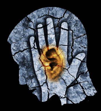 Kırmızı kırık kulak ve baş ile Adam, kulak çınlaması ve kulak sorunları sembolize Blue Male kafa stilize profil. Kuru çatlak toprak ile Fotomontaj. Tinnitus, depresyon u simgeleyen kavram.