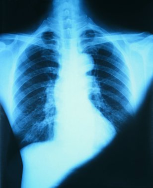 tıbbi X-Ray yakın görünümü