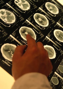 x-ray yakın görünümü