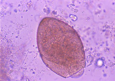 mikroskop slaytının yakın görünümü