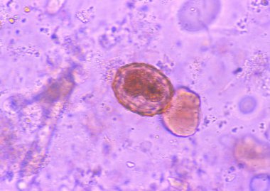 mikroskop slaytının yakın görünümü