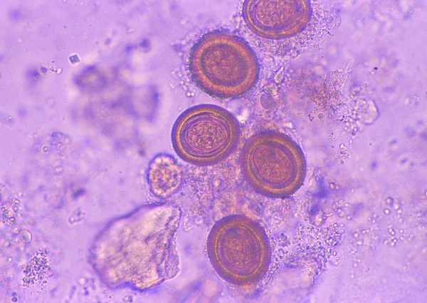 Close Upweergave Van Microscoop Dia — Stockfoto