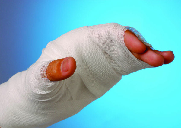 Closeup of  man's arm with long arm plaster