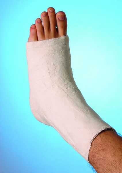 Cropped Section Male Leg Cast Blue Background — Stock Photo, Image