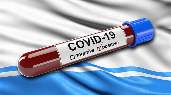 阿尔泰共和国的国旗在风中飘扬 带有Covid 19型血检试管 血检诊断新科罗纳病毒的三维图解概念 图库照片