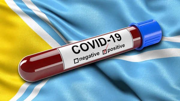 Flagga Tuva Republiken Viftar Vinden Med Positiv Covid Blodprovsrör Illustrationskoncept — Stockfoto