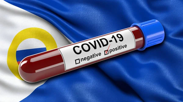 Flagga Chukotka Autonomous Okrug Vinka Vinden Med Positiv Covid Blodprovsrör — Stockfoto