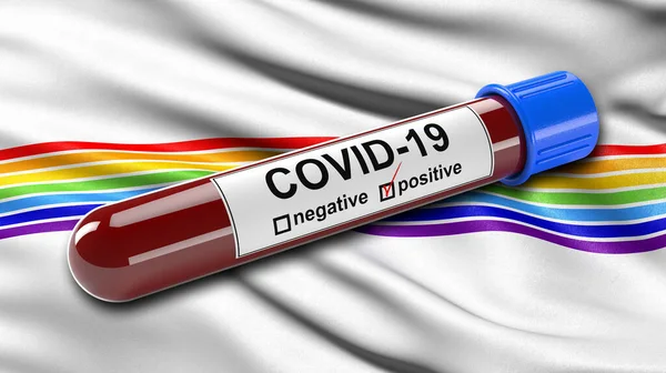 ユダヤ自治州のフラグは 肯定的なCovid 19血液検査管で風に手を振る 新しいコロナウイルスの診断のための血液検査のための3Dイラストコンセプト ストック画像