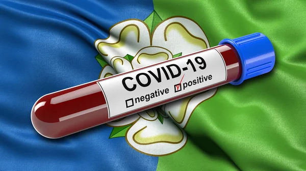 约克郡东行的旗帜在风中飘扬 带有Covid 19型血检试管 血检诊断新科罗纳病毒的三维图解概念 免版税图库照片