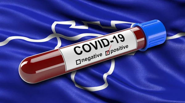 Flagga Tyne Och Wear Viftar Vinden Med Positiv Covid Blodprovsrör — Stockfoto