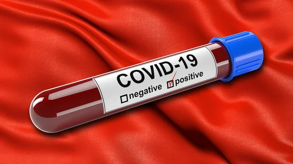 Oruro的旗帜在风中飘扬用Covid 19型血检试管呈阳性血检诊断新科罗纳病毒的三维图解概念 图库图片