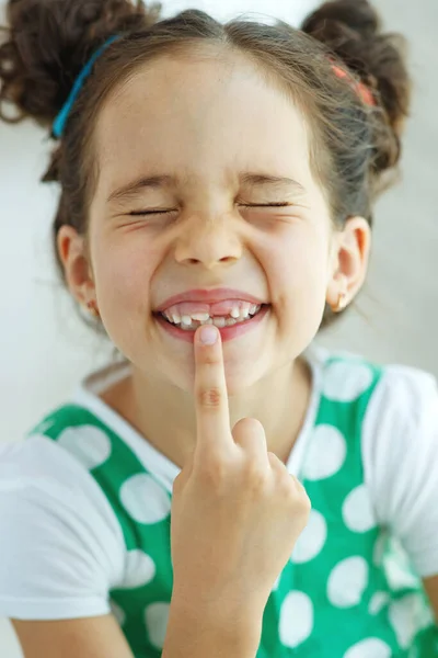 Κοριτσάκι χωρίς δόντι. Το παιδί έχασε ένα δόντι.. — Φωτογραφία Αρχείου