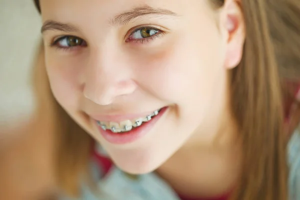 Close up portrait of smiling teenager girl showing dental braces.Isolated on white background. — Stock Photo, Image