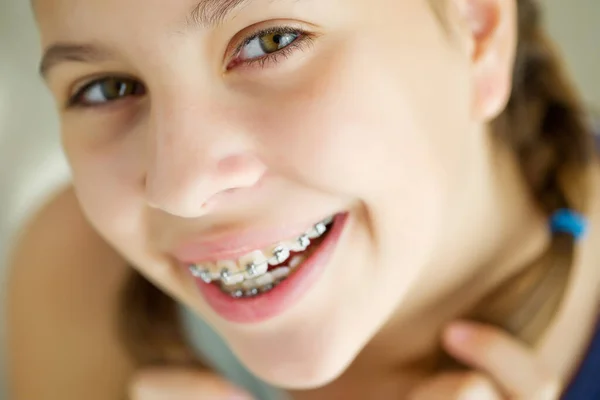 Κοντινό πλάνο πορτρέτο του χαμογελαστού κοριτσιού έφηβος δείχνει οδοντικά βραχιόνια.Απομονωμένο σε λευκό φόντο. — Φωτογραφία Αρχείου