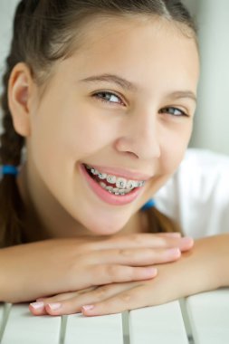 Gülümseyen genç kızın diş teli gösteren portresi. Beyaz arka planda izole edilmiş..