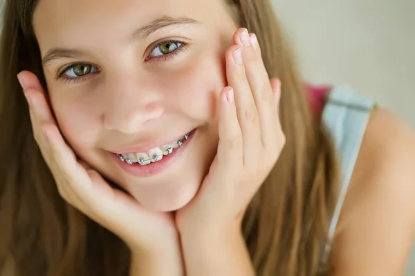 Κοντινό πλάνο πορτρέτο του χαμογελαστού κοριτσιού έφηβος δείχνει οδοντικά βραχιόνια.Απομονωμένο σε λευκό φόντο. — Φωτογραφία Αρχείου