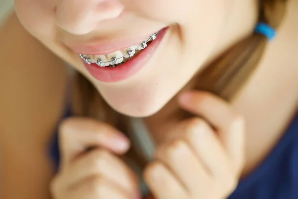 Close up portrait of smiling teenager girl showing dental braces.Isolated on white background. — Stock Photo, Image
