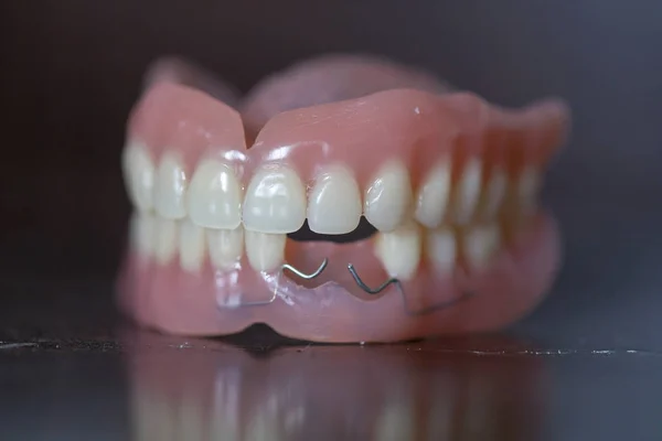 黒い背景に人工医療義歯 — ストック写真