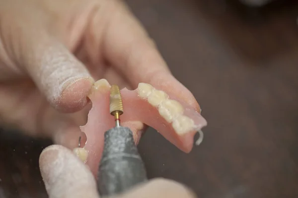 歯科技工所の歯科技工士を人工義歯をクローズ アップ — ストック写真