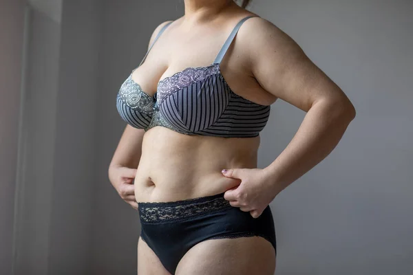 女性リアルボディプラスサイズモデルでランジェリーポーズ 不完全な非理想 — ストック写真