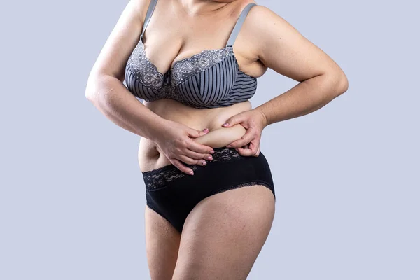 Frau Real Body Size Model Dessous Zeigt Fett Bauch Unvollkommen — Stockfoto