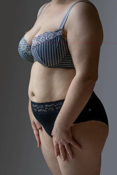Woman Real Body Plus size Model in lingerie posign, imperfect nonideal