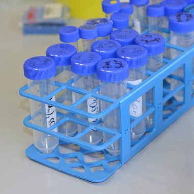 Birçok falcone tüplerini containig çözümleri biyofiziksel araştırma için raf.