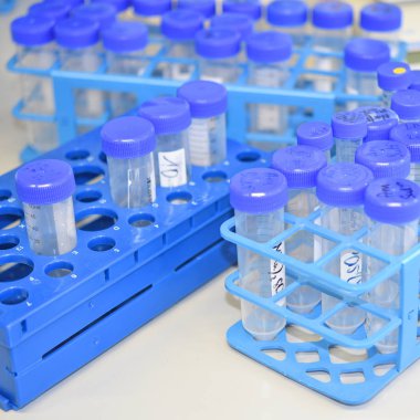 close up of laboratory test tubes