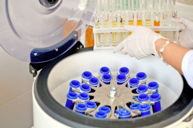 Kliniğin laboratuvarında Elmi Santrifüj'de numune yüklemesi.