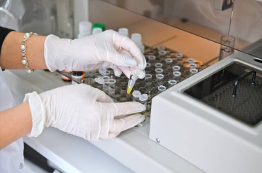 Bir sağlık çalışanı kliniğin laboratuvarında bir oto-biyokimyasal ve immün enzim analizörü çalışır.