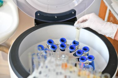 Kliniğin laboratuvarında Elmi Santrifüj'de numune yüklemesi.